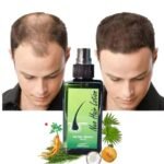 Green Wealth Neo Hair Lotion 120ml Price In Pakistan